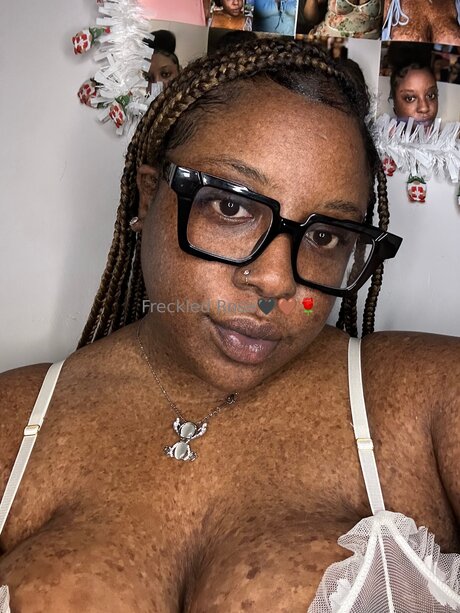 Freckledfantasy5