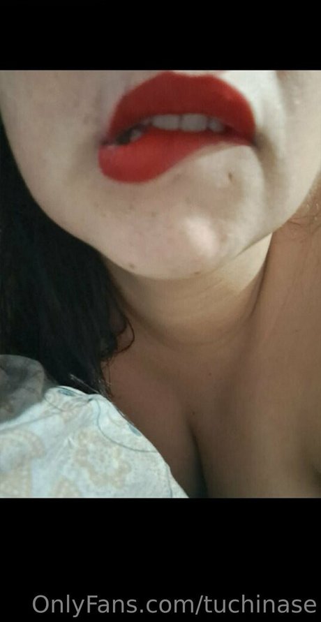 Tuchinase