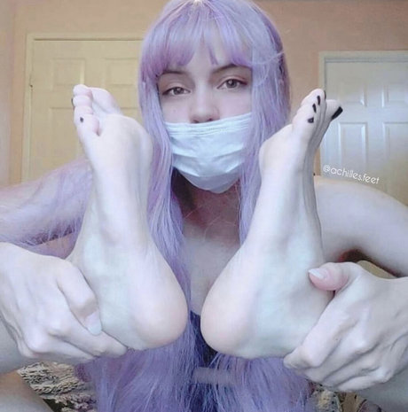 Achilles.heelz