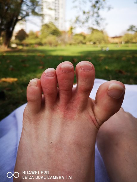 Prettyfeet