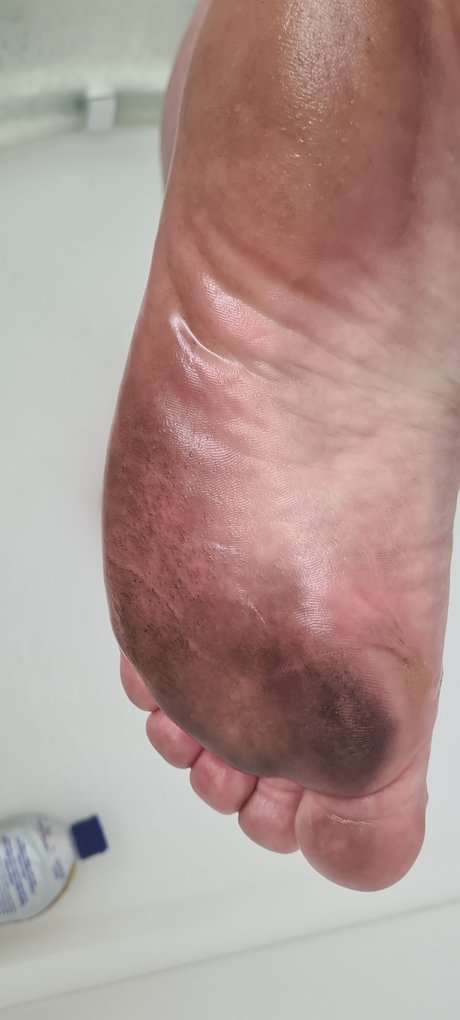 Foto desnuda filtrada de OnlyFans de Philfeet