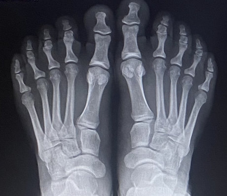 Bbfeet