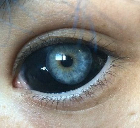Blu