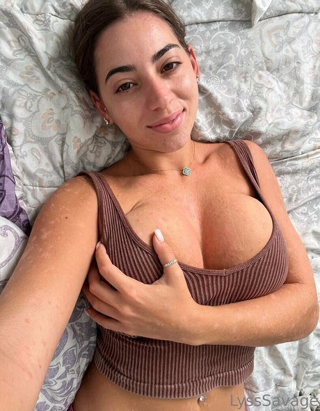Lysssavage