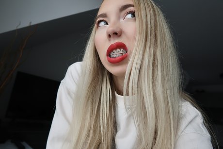 Kate In Braces