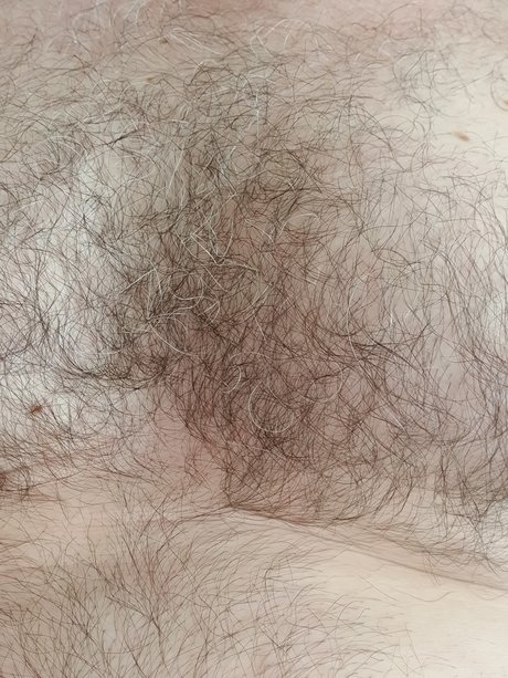 Foto desnuda filtrada de OnlyFans de Harry Mann