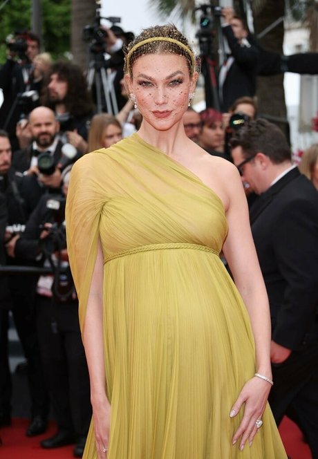 Karlie Kloss