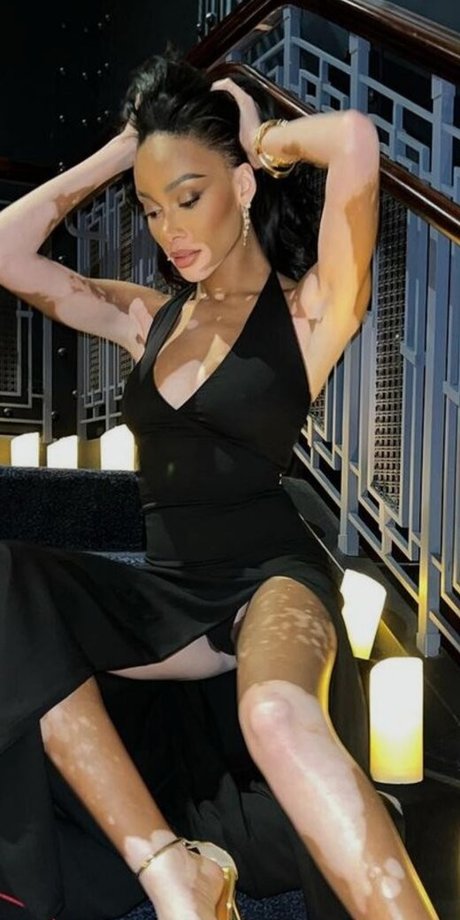 Winnie Harlow