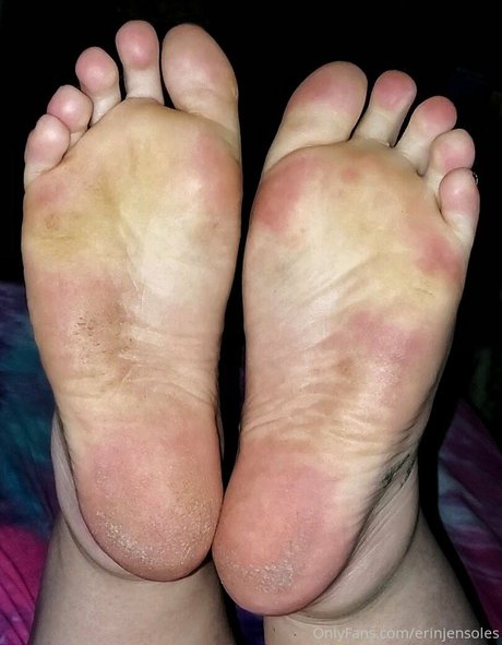 Erinjensoles