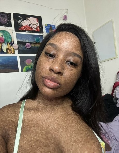 Freckledn