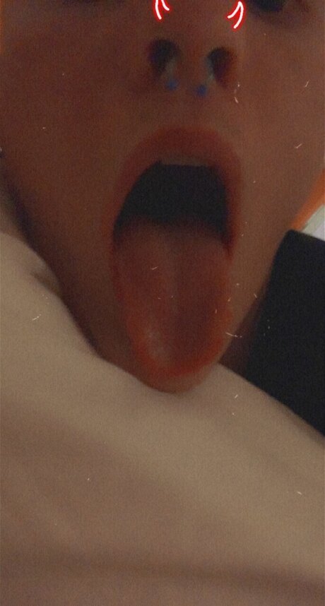 Axo