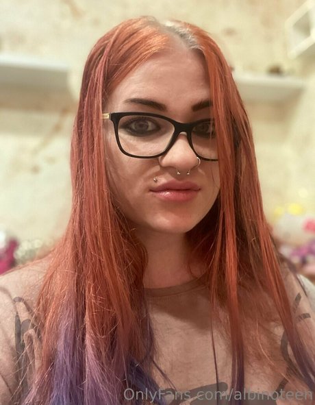 Albinoteen