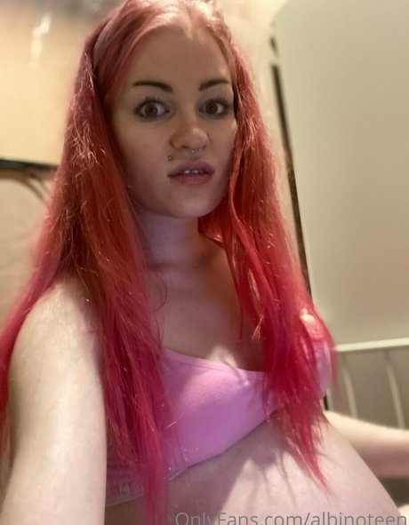 Albinoteen