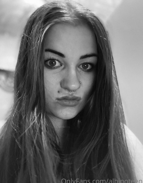 Albinoteen