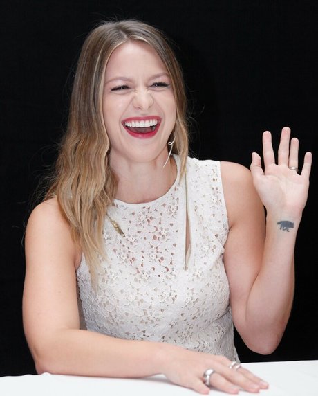 Foto desnuda filtrada de OnlyFans de Melissa Benoist