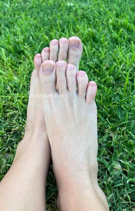 Myposedtoes