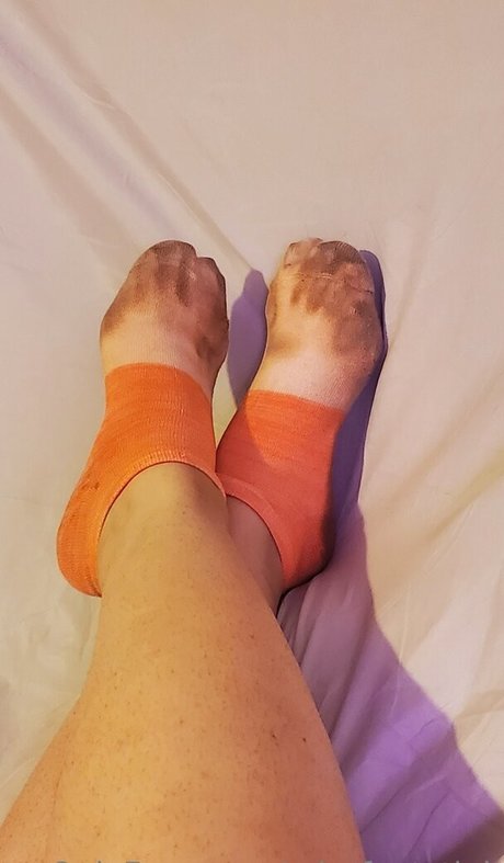 Missfeetstink