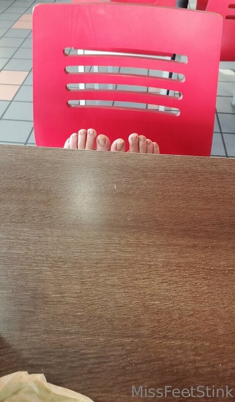Missfeetstink