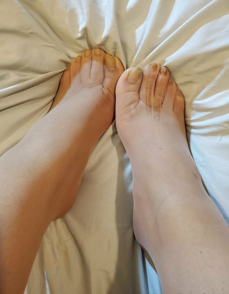 Missfeetstink