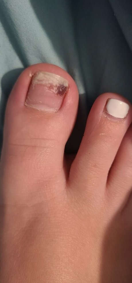 Smelliefeetsweetie