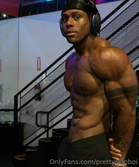 Prettyskinboi