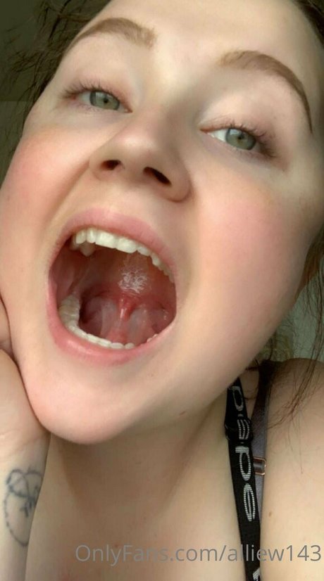 Toxicallietongue