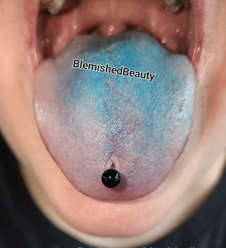Blemishedbeauty