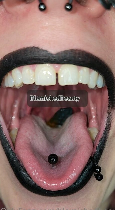 Blemishedbeauty