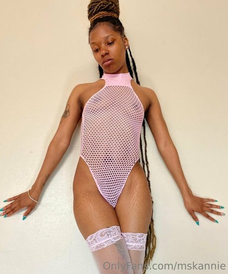 Mskannie